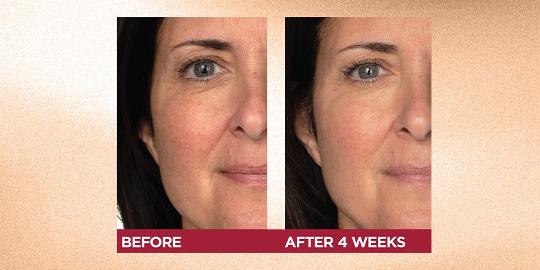 In-Article-water-based-hydration-for-any-skin-type_1